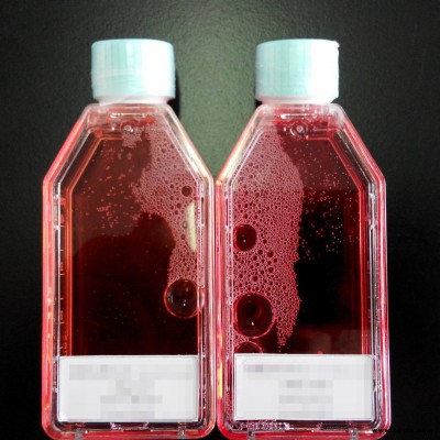 人B淋巴母细胞 B淋巴 母细胞 HMy2 CIR SHBCC E00265