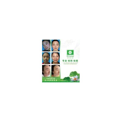 美白祛斑加盟翌芙莱