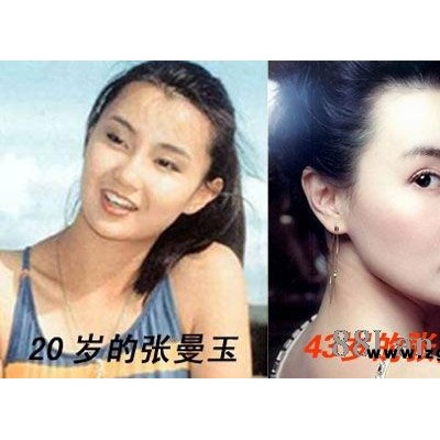 瑞士羊胎素  恢复青春的秘诀