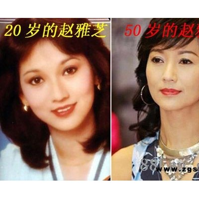 瑞士羊胎素 羊胎素注射 羊胎素功效