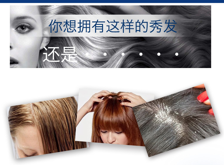 隆力奇洗发水新活力去屑多效呵护芦荟丝质顺滑控油洗发乳1000mL示例图4