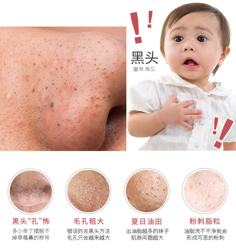 热销吸黑头神器电动洁面仪家用脸部去黑粉刺头机毛孔清洁美容仪示例图6