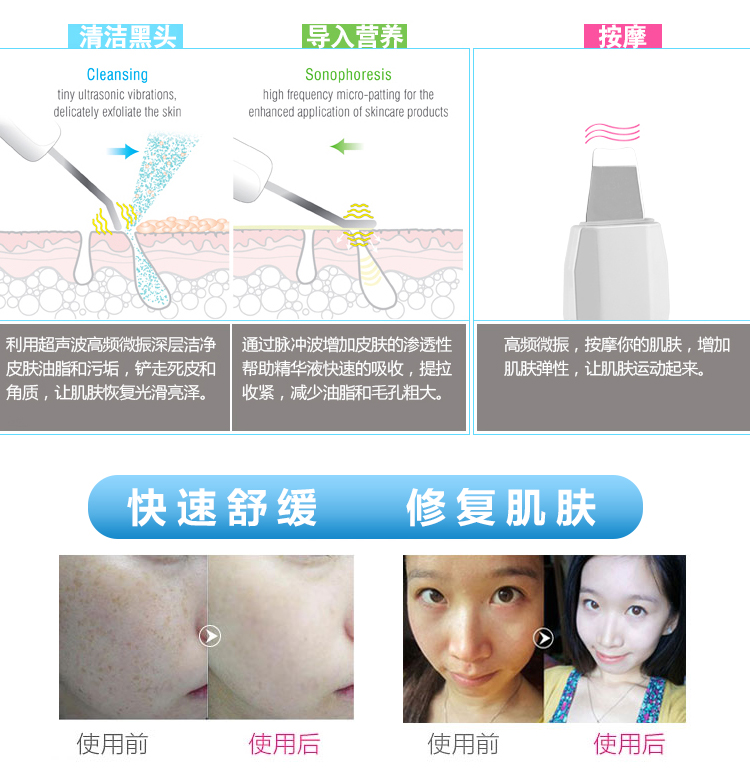 包邮洁面仪液晶双头铲皮机电子美容仪去死皮去黑头脸部清洁按摩仪示例图8