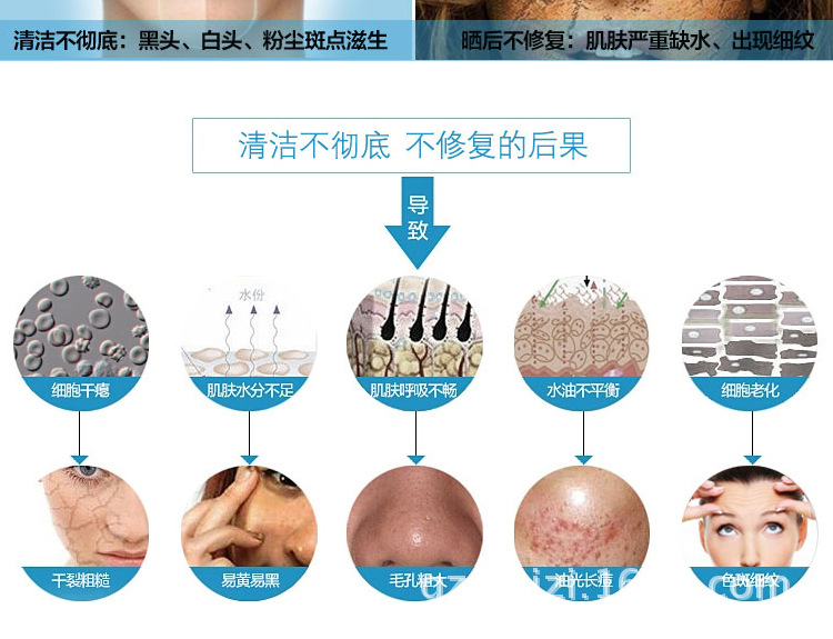 液晶单头铲皮机超声波离子洁面仪美容仪器去角质黑头去死皮导入仪示例图4