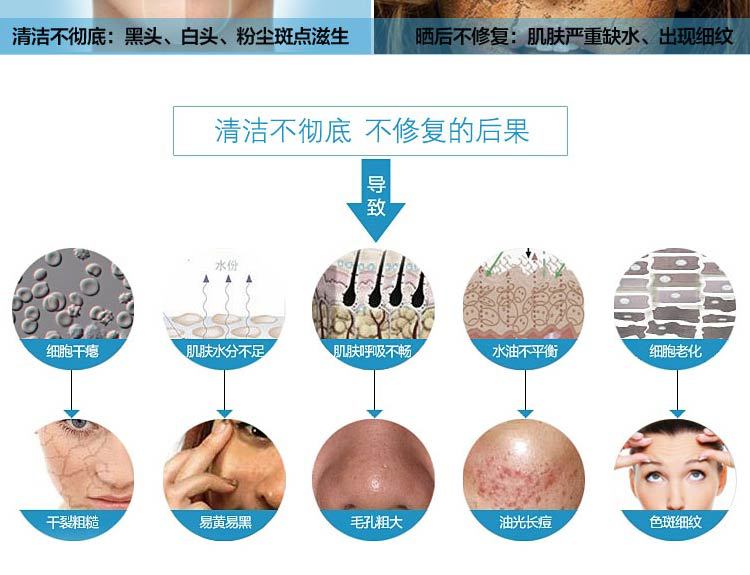 大功率家用超声波铲皮机洁面仪毛孔清洁器去黑头角质导入美容神器示例图4