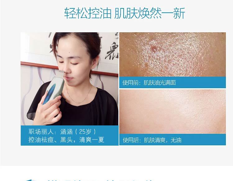 大功率家用超声波铲皮机洁面仪毛孔清洁器去黑头角质导入美容神器示例图14